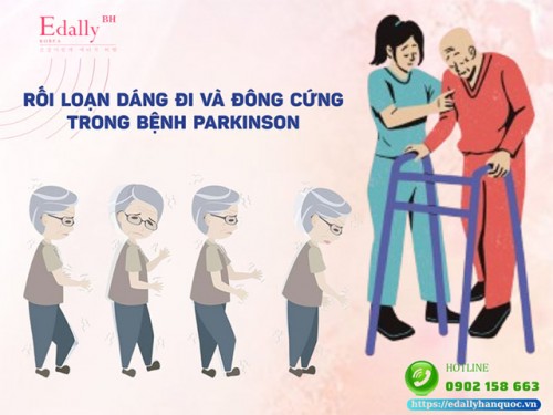 Rối Loạn Dáng Đi Và Đông Cứng Dáng Đi Trong Bệnh Parkinson Xử Lý Thế Nào?