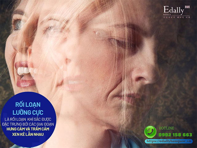 Rối Loạn Lưỡng Cực Và Những Điều Cần Phải Biết