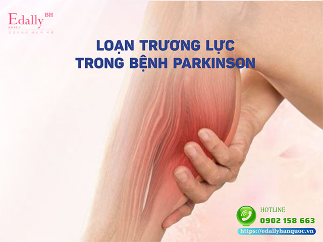 Rối loạn trương lực cơ trong bệnh Parkinson và cách điều trị hiệu quả