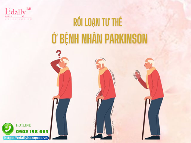 Rối loạn tư thế trong bệnh Parkinson và cách điều trị hiệu quả