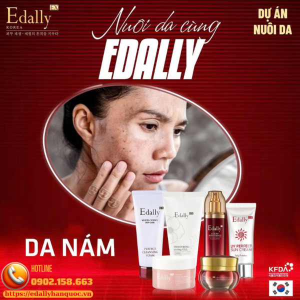 Routine chăm sóc da nám trên nền da yếu