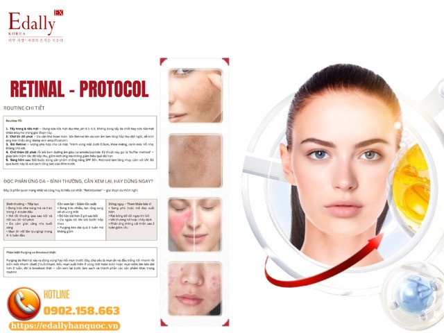 Routine chi tiết buổi tối khi sử dụng Retinal và cách đọc phản ứng da