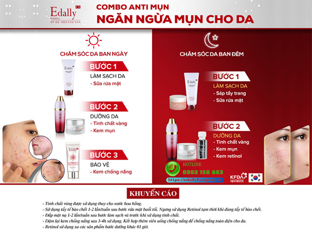 Routine sklincare ngăn ngừa mụn chai cứng dưới da và viêm