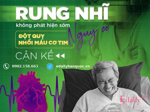 Rung Nhĩ Và Mối Liên Hệ Với Đột Quỵ, Nhồi Máu Cơ Tim