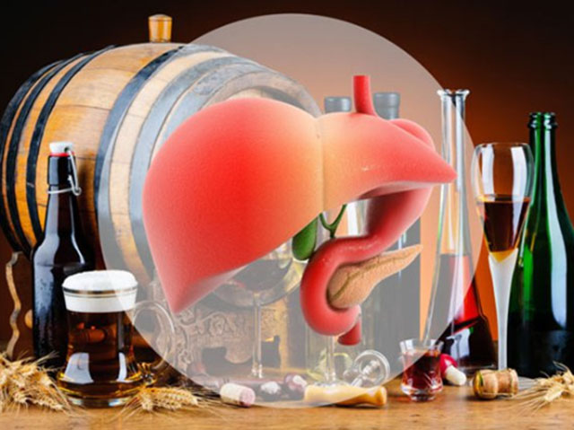 Các chất kích thích có trong rượu bia sẽ làm giảm chức năng gan và gây xơ gan