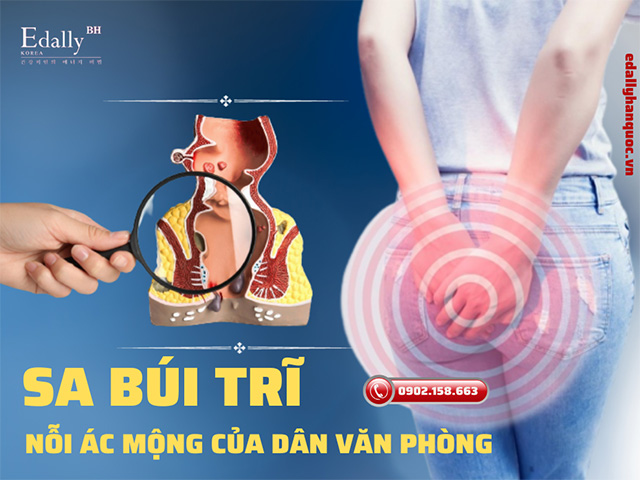 Sa búi trĩ là nỗi ám ảnh thường gặp ở dân văn phòng