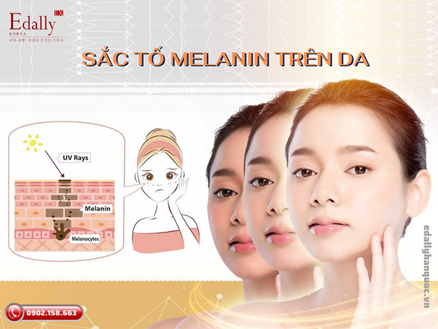 Sắc tố melanin trên da là gì và có vai trò gì đối với làn da?