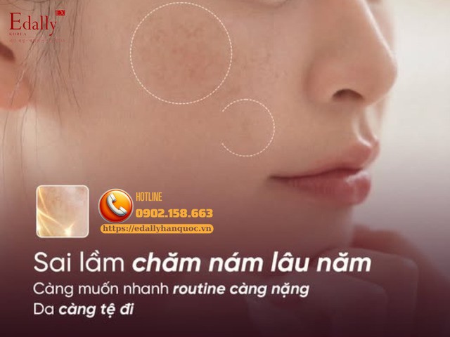 Sai lầm khi chăm sóc da nám lâu năm là càng muốn nhanh thì routine càng nặng khiến da càng tệ đi