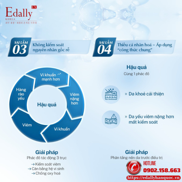 Sai lầm khi xử lý không đúng khiến bạn thất bại trong điều trị mụn viêm nặng Sai lầm khi xử lý không đúng khiến bạn thất bại trong điều trị mụn viêm nặng