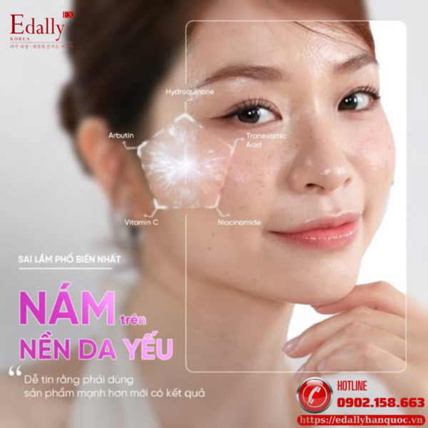 Sai lầm phổ biến nhất khi xử lý nám trên nền da yếu là dễ tin rằng phải dùng sản phẩm mạnh hơn mới có kết quả