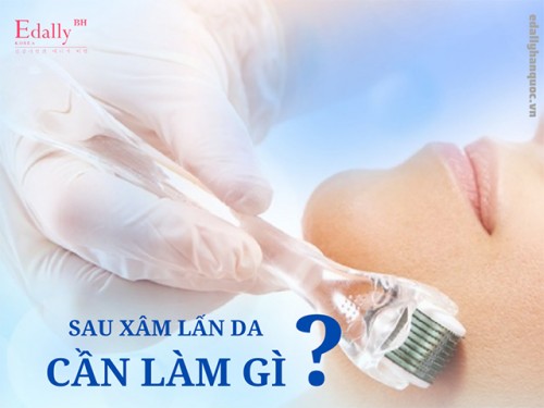 Sau Xâm Lấn Da Cần Làm Gì Để Phòng Ngừa Biến Chứng?