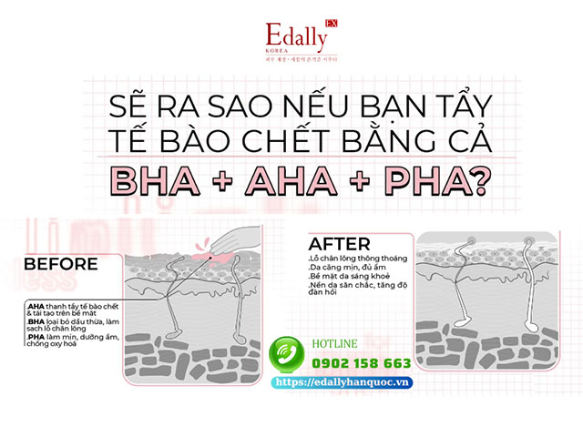 Sẽ ra sao nếu bạn tẩy tế bào chết bằng cả BHA + AHA + PHA?