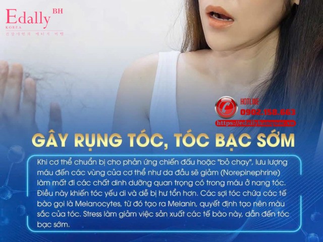 Stress làm tăng rụng tóc và khiến tóc bạc sớm hơn