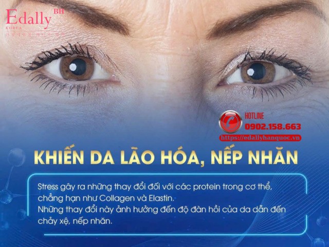 Stress khiến da nhanh lão hóa và xuất hiện nếp nhăn