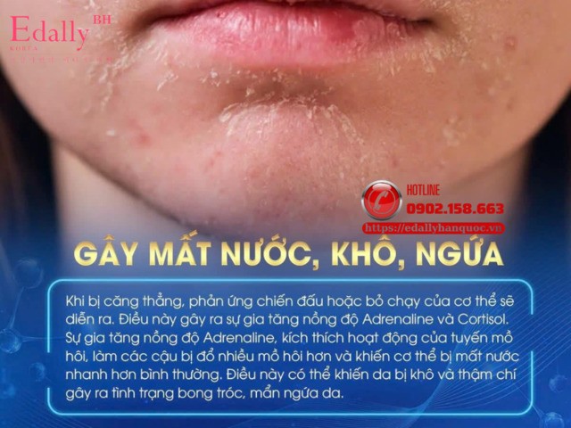 Stress làm da mất nước, khô và ngứa