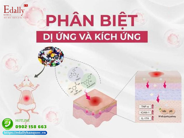 Phân biệt giữa dị ứng và kích ứng khi dùng mỹ phẩm