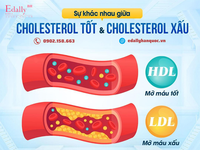 Sự khác nhau giữa cholesterol tốt và cholesterol xấu là gì?