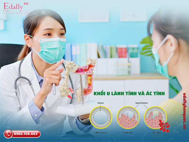 Sự khác nhau giữa khối u trực tràng lành tính và ác tính