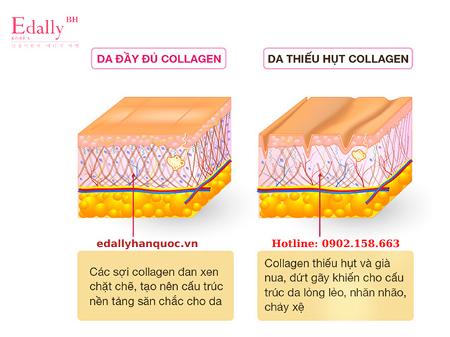 Collagen - Sứ mệnh duy trì làn da