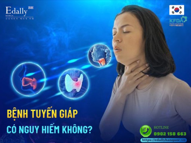 Mức độ nguy hiểm của các bệnh lý tuyến giáp, ai cũng nên biết