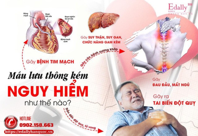 Tuần hoàn máu kém nguy hiểm như thế nào?
