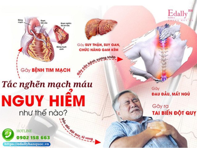 Sự nguy hiểm khi mạch máu bị tắc nghẽn