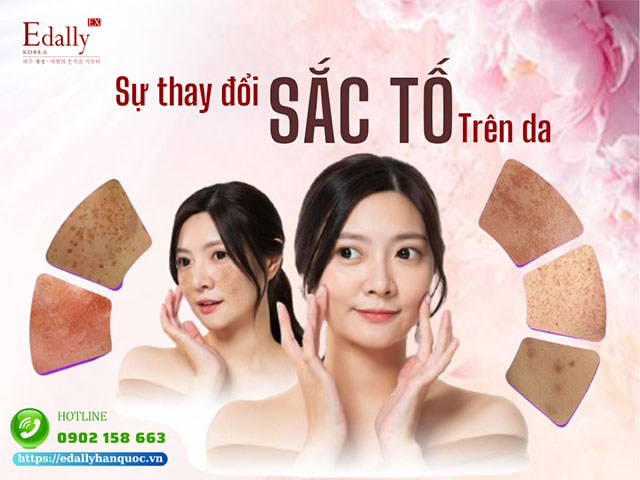 Hiểu về sự thay đổi sắc tố của làn da trên khuôn mặt