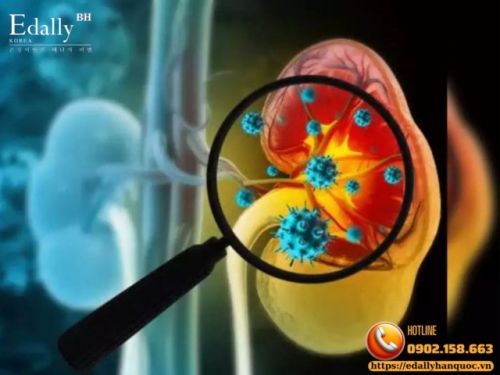 Suy Thận Sớm Ở Người Trẻ Ngày Càng Gia Tăng Và Những Thói Quen Cần Lưu Ý