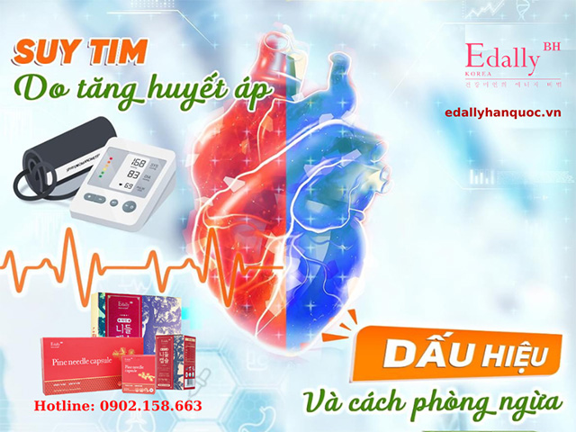 Dấu hiệu suy tim do tăng huyết áp và cách phong ngừa suy tim do tăng huyết áp