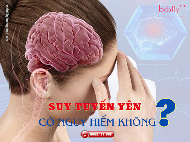 Bệnh suy tuyến yên có nguy hiểm không và có chữa khỏi được không?