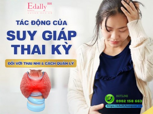 Tác Động Của Suy Giáp Thai Kỳ Đối Với Thai Nhi Và Cách Quản Lý