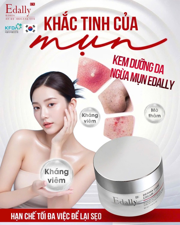 Công dụng của Kem dưỡng da ngừa mụn Edally EX Hàn Quốc 
