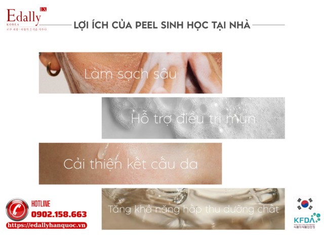 Peel da sinh học tại nhà có tác dụng gì?