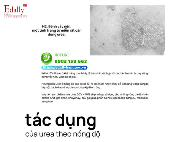 Tác dụng của Urea trong mỹ phẩm theo nồng độ