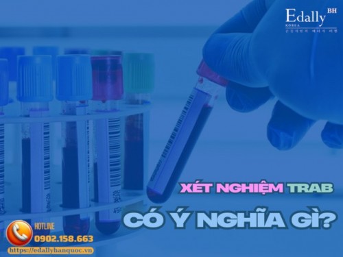 Xét Nghiệm Kháng Thể TRAb Có Những Giá Trị Gì?