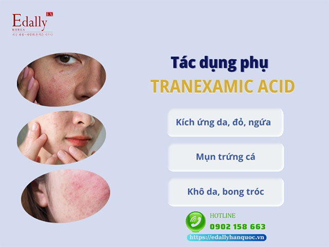 Tác dụng không mong muốn của Tranexamic acid