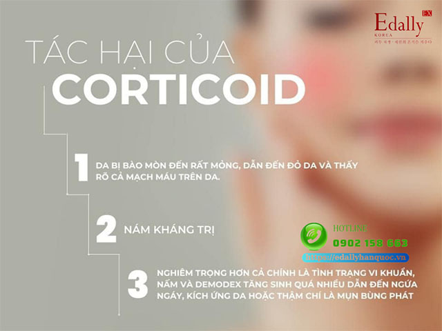 Tác hại của Corticoid đối với làn da