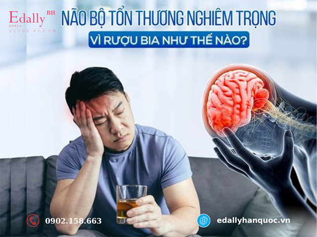 Tác hại của rượu bia đối với não bộ và hệ thần kinh như thế nào?