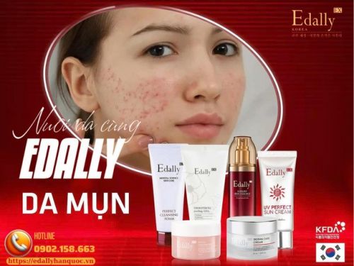 Vì Sao Điều Trị Mụn Viêm Nặng Càng Nhiều Càng Nặng Hơn?