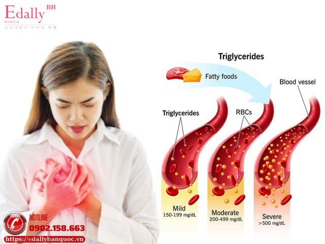 Tại sao chúng ta cần quan tấm đến chỉ số triglyceride trong máu?