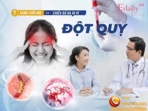Tại Sao Có Người Vừa Cười Nói Sáng Nay Chiều Đã Ra Đi Vì Đột Quỵ?