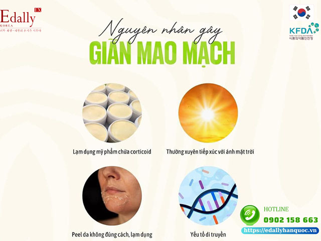 Tại sao da lại bị giãn mao mạch?