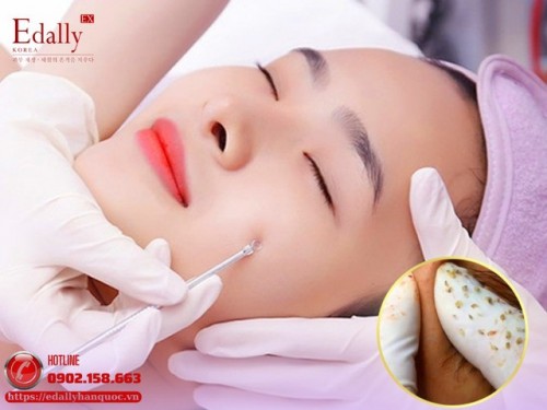 Tại Sao Sau Khi Đi Spa Nặn Mụn Một Buổi, Mụn Lại Lên Nhiều Hơn? 