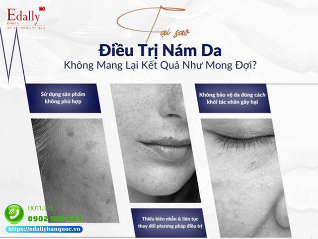 Lý do vì sao điều trị tám da không mang lại hiệu quả như mong đợi