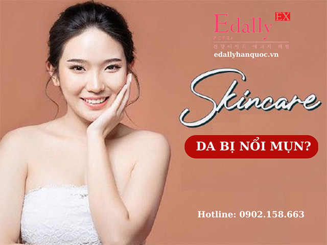 Vì sao khi bắt đầu skincare da lại bị nổi mụn?