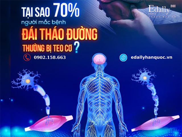 Tại sao 70% người mắc bệnh đái tháo đường thường gặp biến chứng teo cơ?