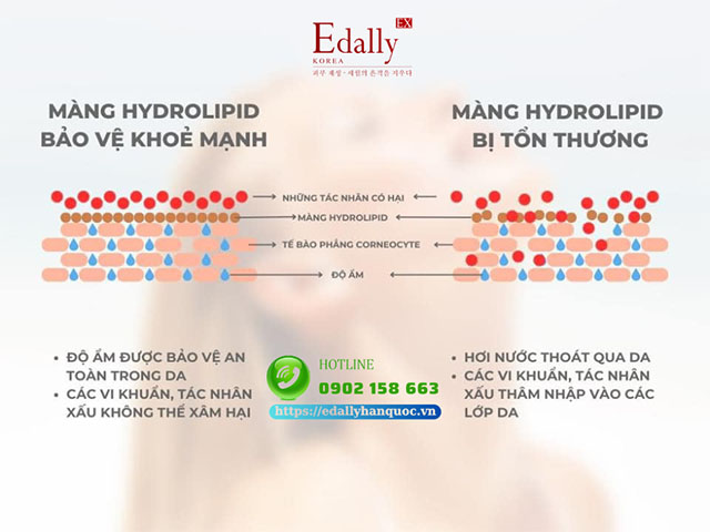 Tầm quan trọng của lớp màng hydrolipid trên da