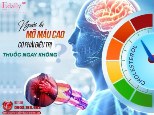 Tăng Mỡ Máu Có Cần Uống Thuốc Ngay Không?