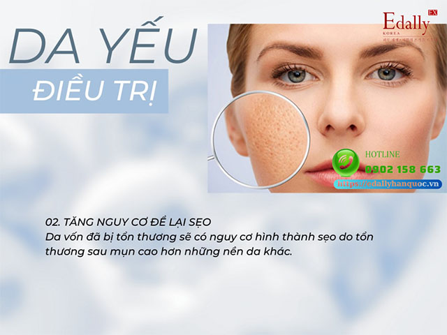 Tăng nguy cơ để lại sẹo là thách thức trong điều trị nền da yếu