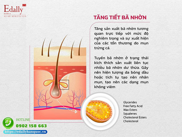 Bã nhờn gây rối loạn sừng hóa và chức năng hàng rào bảo vệ da